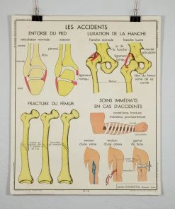 Scout Vintage French School Science Poster- Joints And Fractures